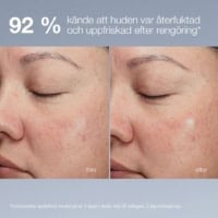 Hud efter rengöring, synlig förbättring.